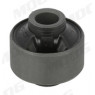 Moog SU-SB-18017 - Trailing Arm Mount/Bush (Front Left Hand+Right Hand)