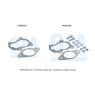 BM Catalysts FK80232 - Fitting Kit-Catalyst (Front)